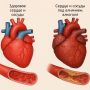 Алкоголь - фактор риска сердечно-сосудистых заболеваний