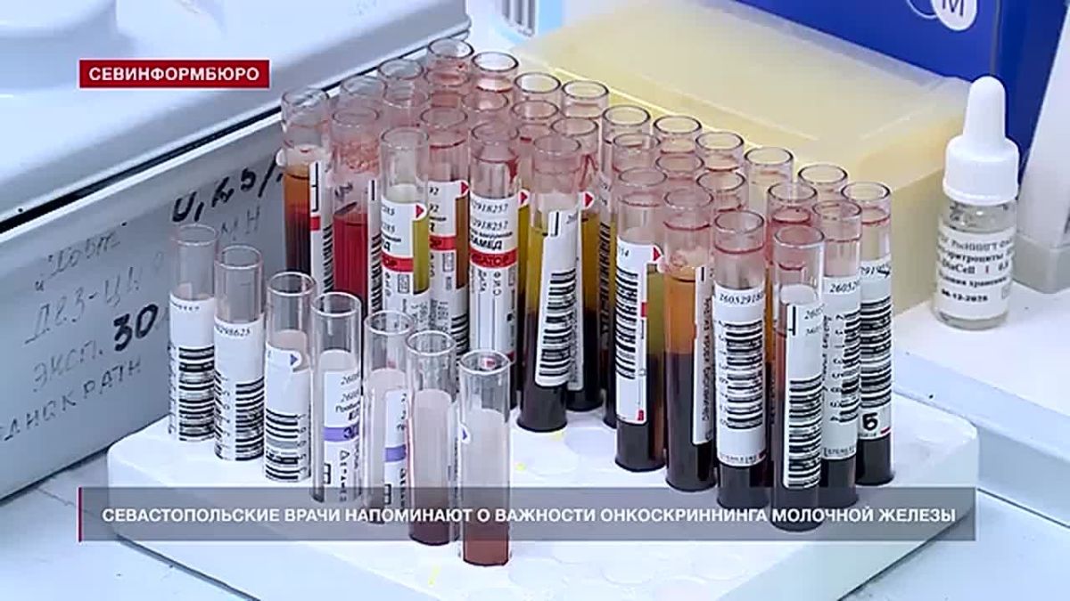 Севастопольские врачи напоминают женщинам о важности онкоскриннинга молочной железы